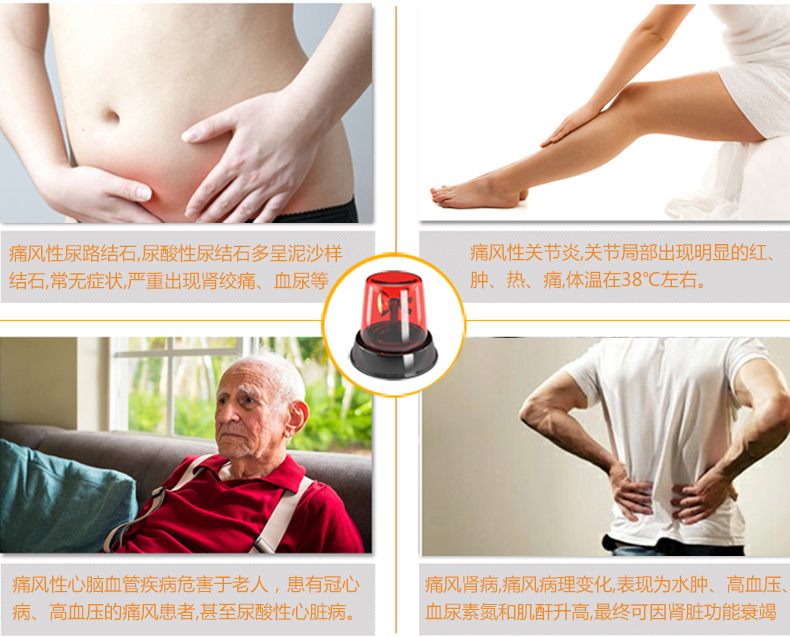 優(yōu)速型血糖尿酸測試儀家用測尿酸 尿酸儀