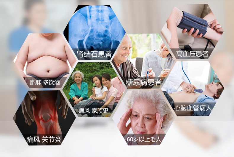 優(yōu)速型血糖尿酸測試儀家用測尿酸 尿酸儀