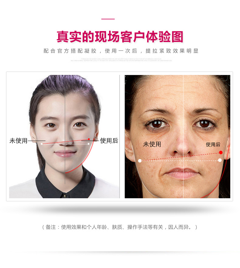 日本娜蜜絲nanoskin嫩膚儀美容儀器家用 臉部射頻瘦臉導(dǎo)入導(dǎo)出